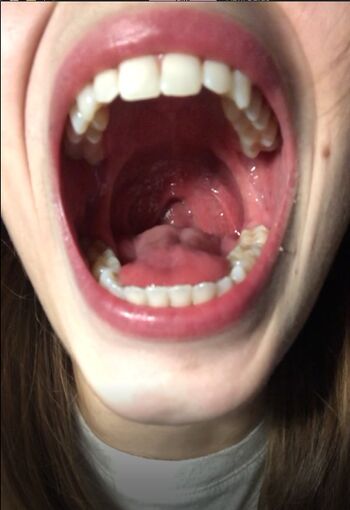 Aprilburps