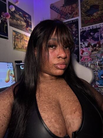 freckledn