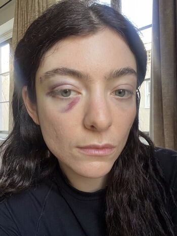 Lorde